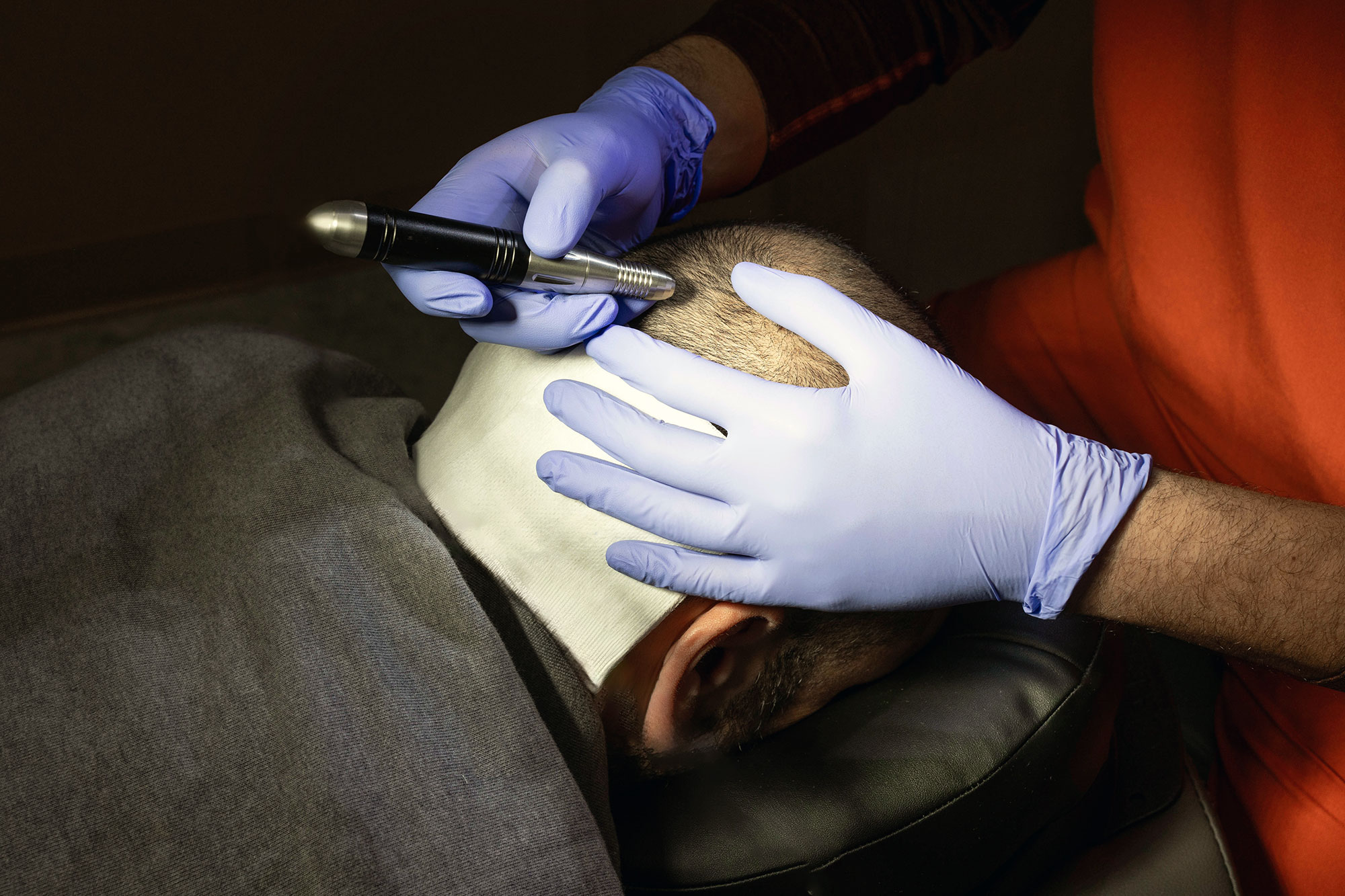 Dr. Doshi performing hair restoration